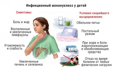 Симптомы при инфекционном мононуклеозе у детей и рекомендации по выздоровлению