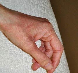 покраснение кожи и раздражение на руках чешется