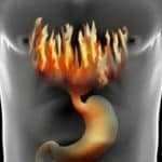 Творог и сметана при грудном вскармливании: можно ли кормящей маме в первый месяц и дальше