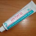 Мастит у кормящей матери: причины, симптомы, лечение в домашних условиях и профилактика5