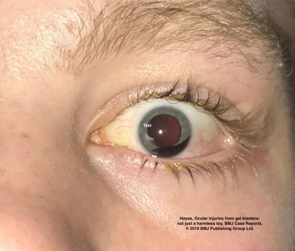 Фотография: Смертельные игры: 10 самых опасных и вредных для здоровья детских игрушек №6 - BigPicture.ru