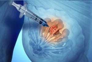 Болит грудь при кормлении: покалывание и набухание молочных желез при грудном вскармливании, как бороться с проблемой19