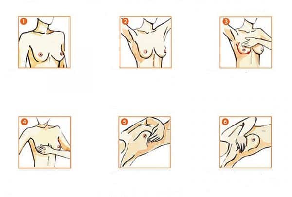 Сдавление молочной железы при грудном вскармливании: причины, лечение, отличия лактостаза от мастита1