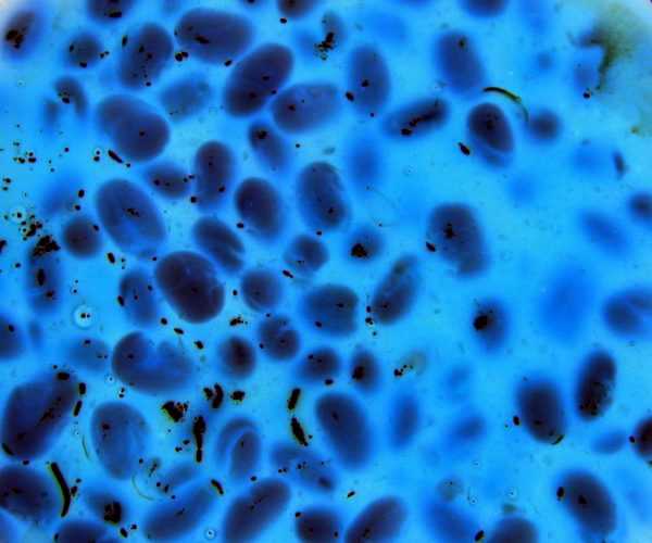 Анализ грудного молока на стерильность, жирность и антитела: как и где сдавать кормящей маме