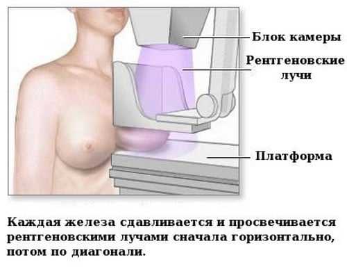 Болит грудь при кормлении: покалывание и набухание молочных желез при грудном вскармливании, как бороться с проблемой20