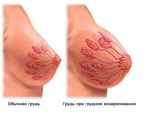 Болит грудь при кормлении: покалывание и набухание молочных желез при грудном вскармливании, как бороться с проблемой0