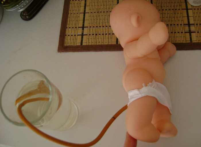 Правильное использование газоотводной трубки для малышей Процедура использования газоотводной ректальной трубки для детей