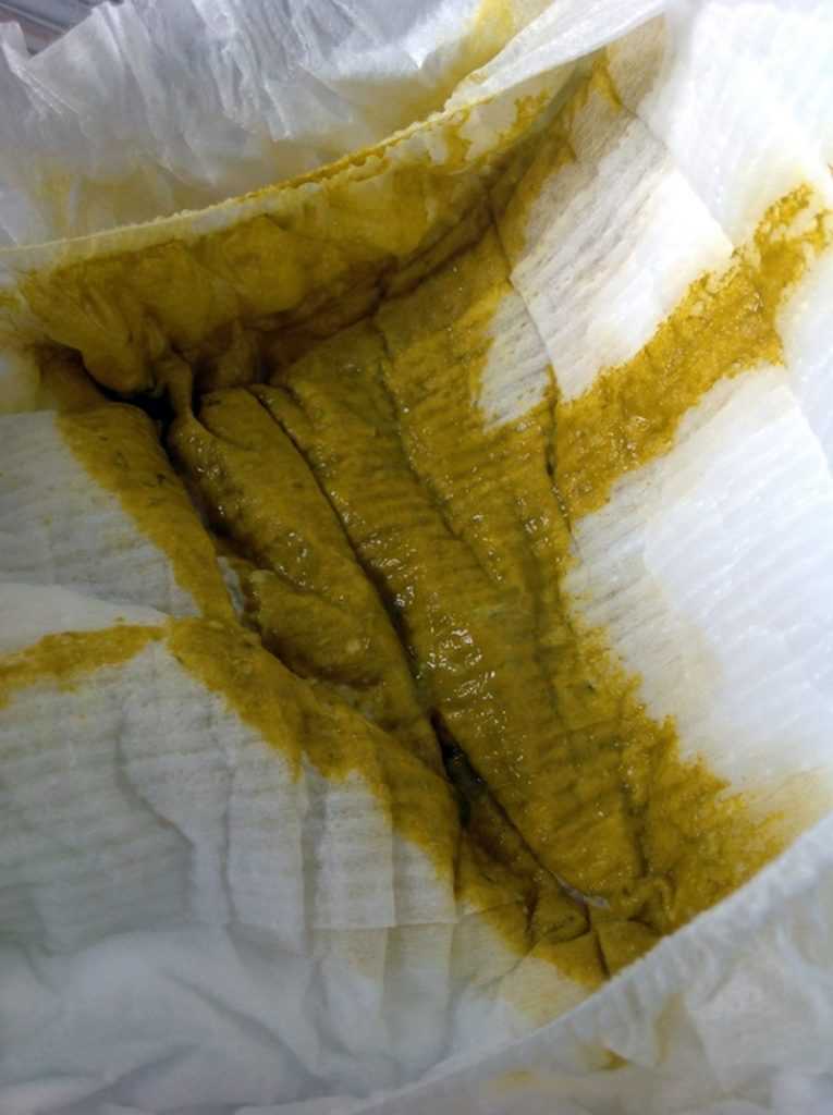 Зеленый стул у грудничка: причины и лечение